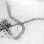 Wirus Ebola fot. F.A. Murphy (public domain)