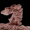 Bakteria E. coli powiększona 10 tys. razy fot. WikimediaCommmons