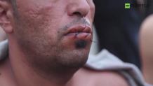Protest przy granicy grecko-macedońskiej. Imigranci zaszyli sobie usta