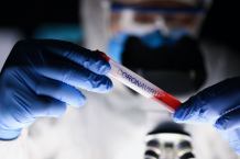 Koronawirus w regionie: sześć nowych zachorowań, żadnego przypadku śmiertelnego
