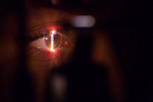 Jak działa laserowa korekta wzroku?